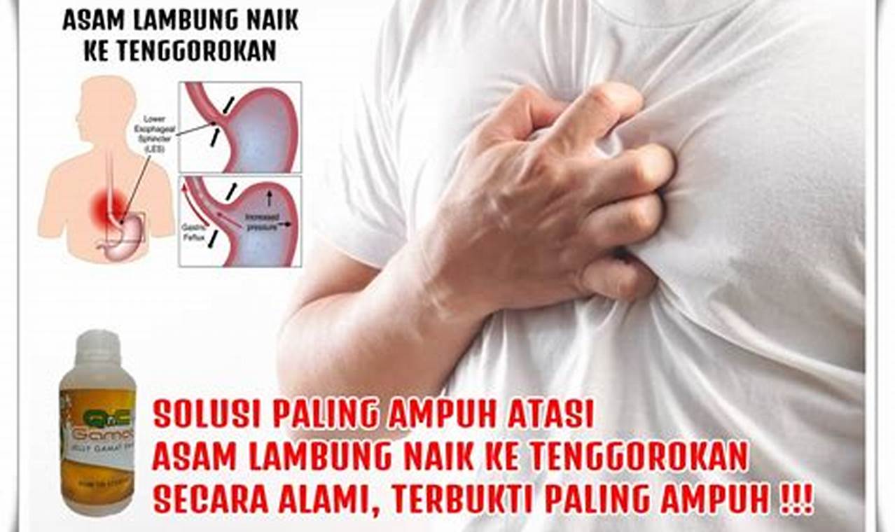 Cara Mengatasi Lambung: Panduan Lengkap Untuk Mengatasi Masalah Lambung